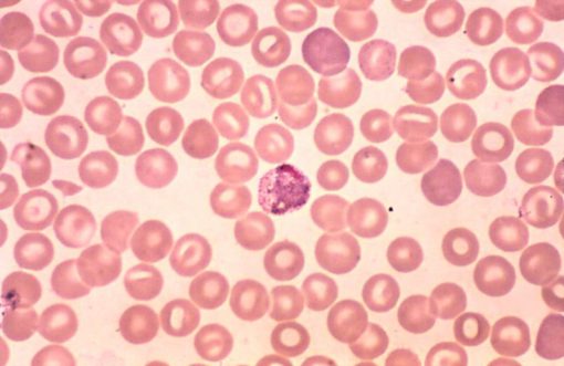 Plasmodium (PM043)