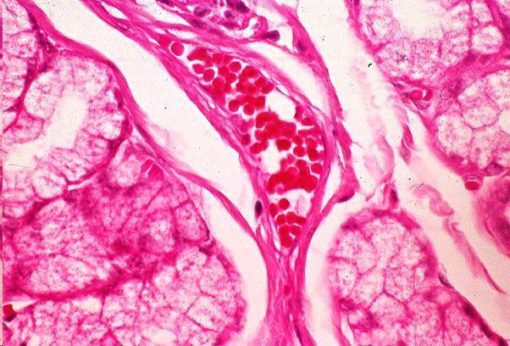 Fibrous tissue (PM056)