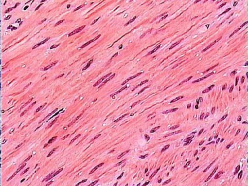 Smooth muscle , human (PM058)