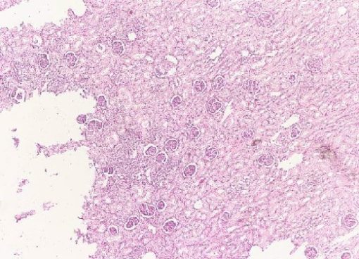 Infected Liver t.s (PM063)