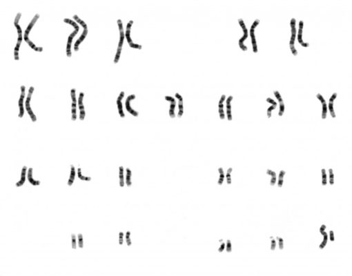 Human Chromosomes (PM074)